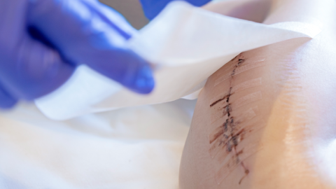 Injecties en vaccinaties